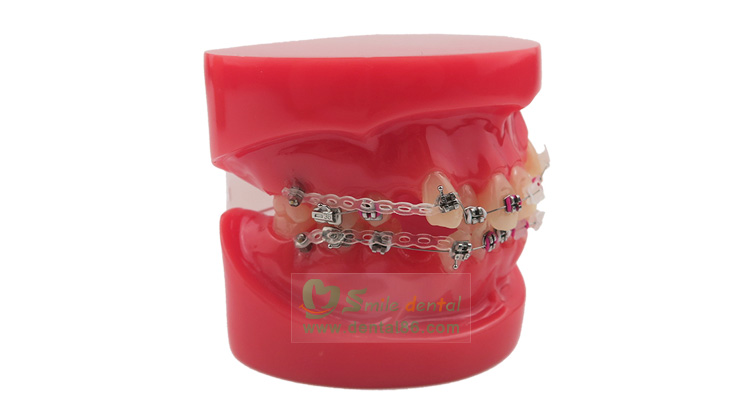 Orthodontic Model